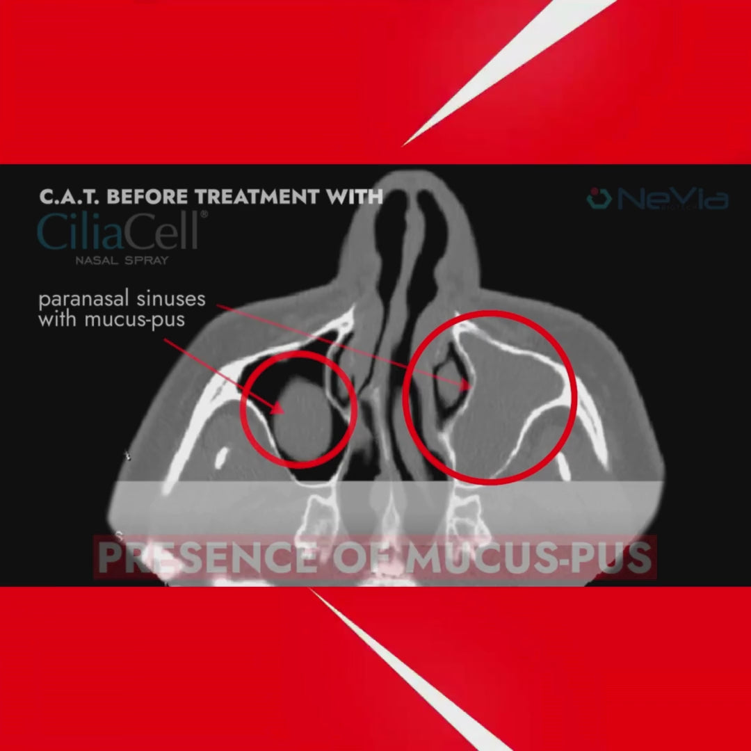 Carica video: CiliaCell Spray Nasale - Bambini